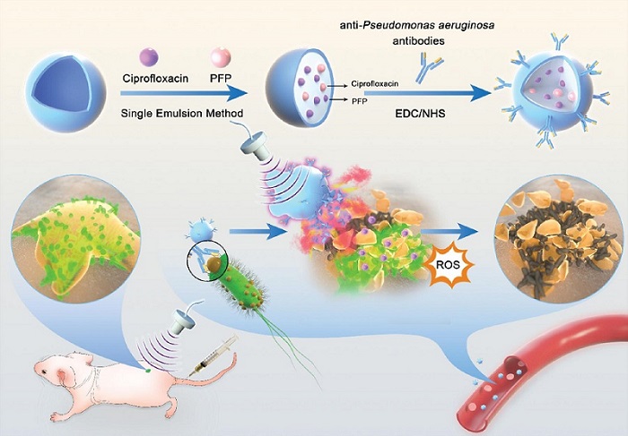 Image: Schematic diagram of the ultrasound-stimulated phase-shift nanoparticle drug delivery system for biofilm therapy (Photo courtesy of BIO Integration)