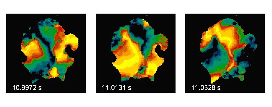 Image: Spatial-temporal excitation pattern during cardiac fibrillation on the surface of heart (field of view 6 x 6 cm2). Color code: black = resting, yellow = excited (Photo courtesy of MPI for Dynamics and Self-Organization)