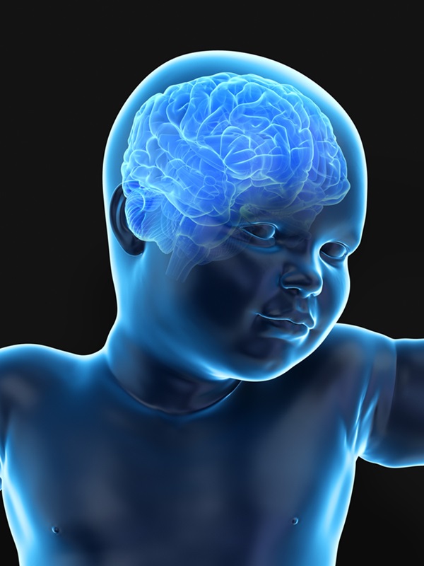 Image: Brain scans for babies could reduce risk of stroke later in life (Photo courtesy of 123RF) Image: Brain scans for babies could reduce risk of stroke later in life (Photo courtesy of 123RF)