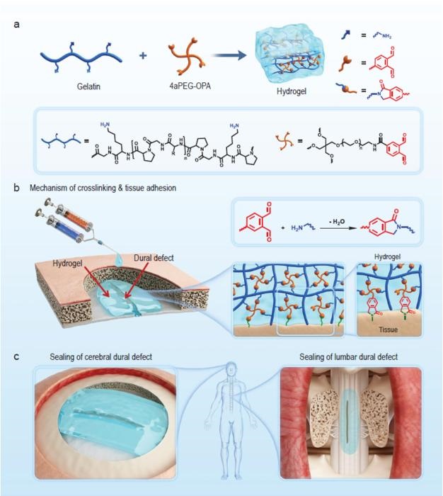 Image: Low-swelling hydrogel sealant for sealing of dural defect and prevention of postoperative adhesion (Photo courtesy of Science China Press)
