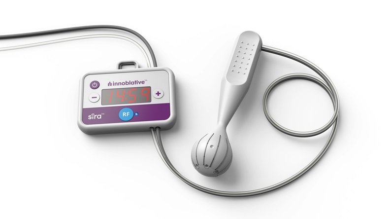 Image: The SIRA RFA electrosurgical device designed specifically for patients undergoing breast-conserving surgery (Photo courtesy of Innoblative Designs)