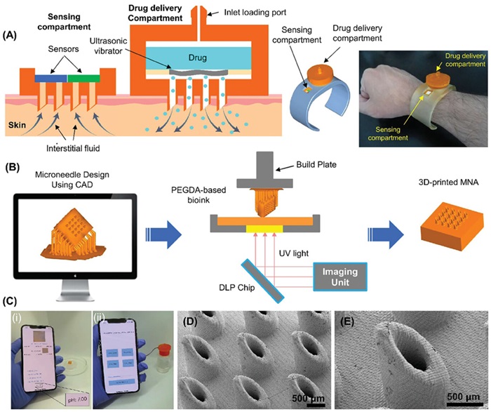 Image: 3D-printed hollow microneedles enable remote-controlled sensing and drug delivery (Photo courtesy of Advanced Healthcare Materials)