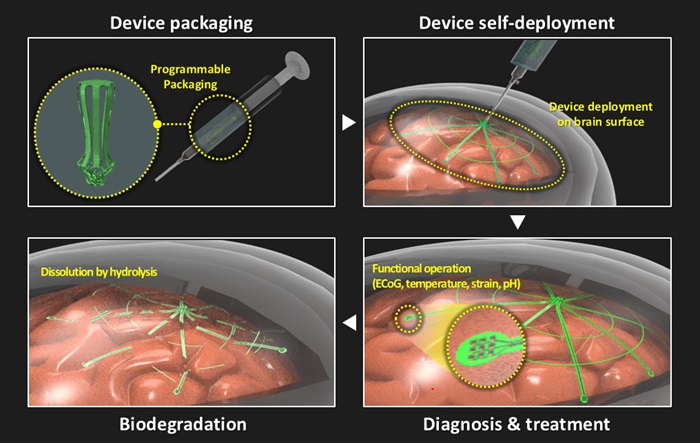 Image: Process of minimally invasive large-area brain surface electrode insertion using a biodegradable electronic tent (Photo courtesy of Seoul National University)