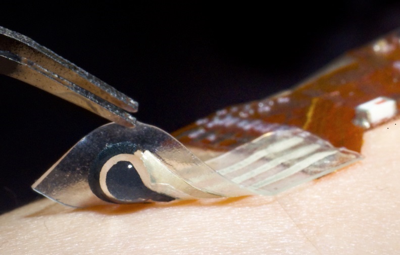 Image: The sensor comprises an ionic electronic bilayer hydrogel that can detect solid state biomarkers from the skin (Photo courtesy of NUS)