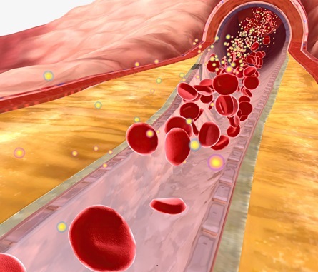 Image: The study reveals how blood flow-driven forces play a vital role in the development and progression of cardiovascular diseases (Photo courtesy of 123RF)