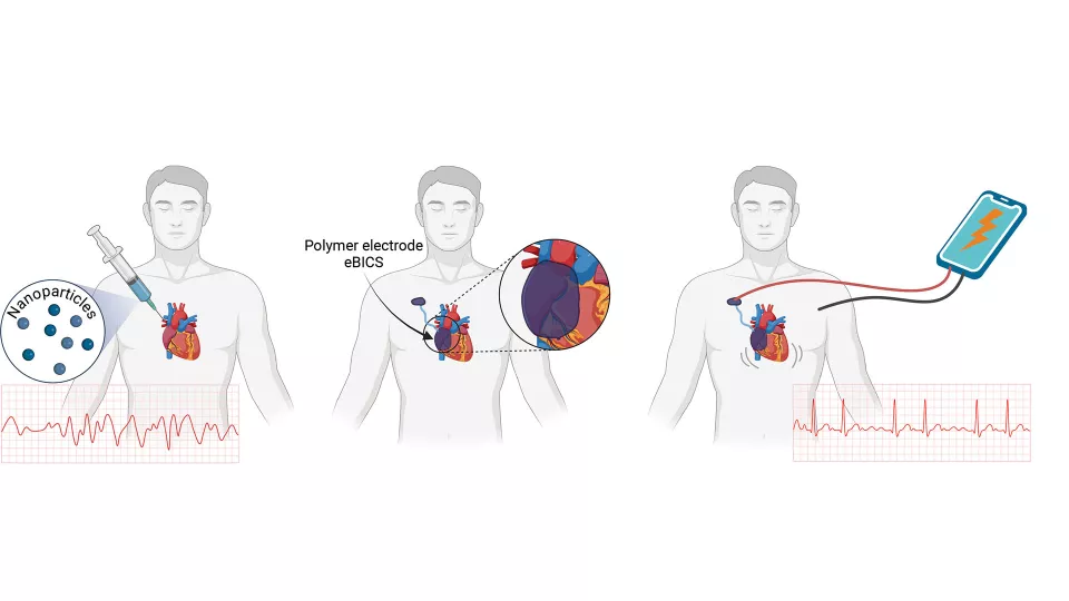 Image: The illustration shows how the injectable heart stimulator is supposed to work when fully developed and tested (Photo courtesy of Lund University)