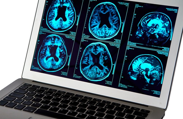 Image: The new AI software could make diagnosing dementia easier and faster for doctors (Photo courtesy of 123RF) Image: The new AI software could make diagnosing dementia easier and faster for doctors (Photo courtesy of 123RF)