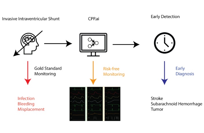 Image: Artificial intelligence-derived intracranial pressure monitors vital information noninvasively (Photo courtesy of Icahn Mount Sinai)