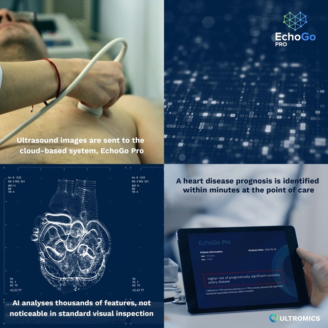 Image: The EchoGo Pro uses AI technology to accurately and instantly predict heart disease risk through non-invasive ultrasound analysis (Photo courtesy of Ultromics) Image: The EchoGo Pro uses AI technology to accurately and instantly predict heart disease risk through non-invasive ultrasound analysis (Photo courtesy of Ultromics)