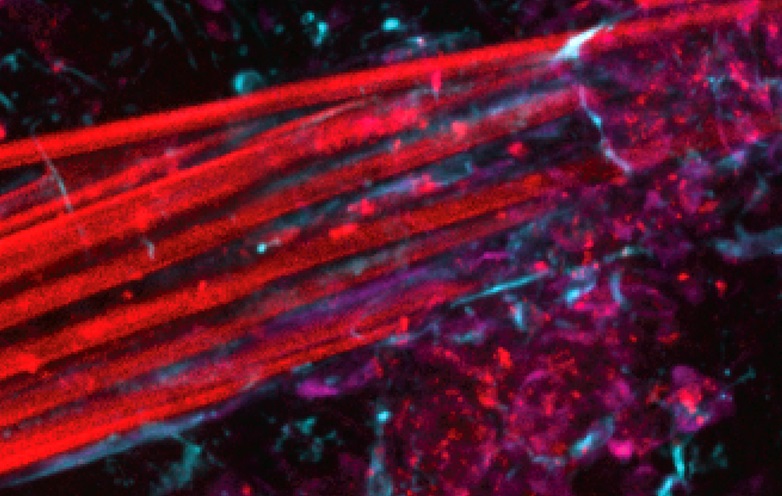 Image: Molecular biosensors that only light up upon binding their targets open vast possibilities for medical diagnostics (Photo courtesy of Wyss Institute at Harvard University)