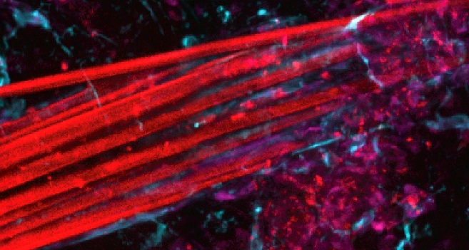 Image: A microscope image of a bundle of extremely fine electrode fibers in the brain (Photo courtesy of Yasar TB et al. Nature Communications 2024, modified