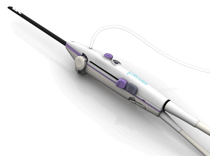 Image: The Sonata System combines real-time intrauterine ultrasound guidance with targeted radiofrequency ablation in an incisionless procedure (Photo courtesy of Gynesonics)