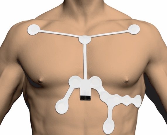 Image: Illustration of the EKG patch produced (Photo courtesy of MG Medical Products)