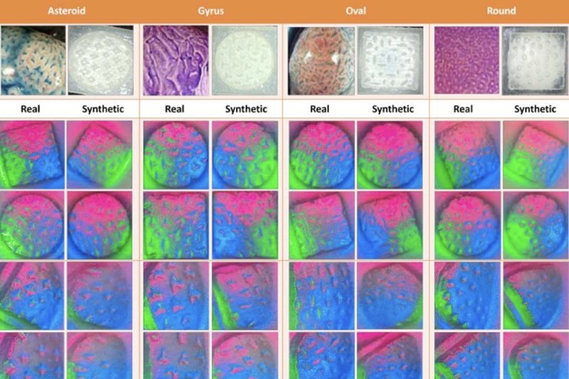 Image: Synthetic images generated by each diffusion model contrasted with the corresponding real textural images of four types of polyps (Photo courtesy of UT at Austin)