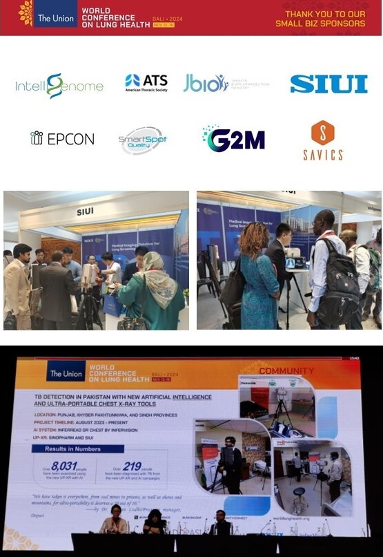 (Top Image): The Union World Conference on Lung Health gathered global experts to discuss advancements in lung health and tuberculosis prevention and treatment. (Middle): SIUI, as a recommended equipment provider for tuberculosis screening by the Global Fund, introduced the portable DR system equipped with AI diagnosis solutions for TB to tuberculosis experts from Africa and Southeast Asia. (Bottom Image): Since 2023, a non-profit organization in Pakistan focused on TB-related innovation has been utilizing SIUI’s portable TB screening solution to conduct decentralized TB screening across the country.