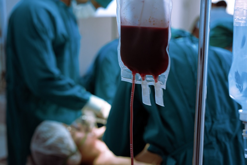 Image: Taking out half a liter of blood before a major liver surgery reduces blood loss and transfusions (Photo courtesy of 123RF)