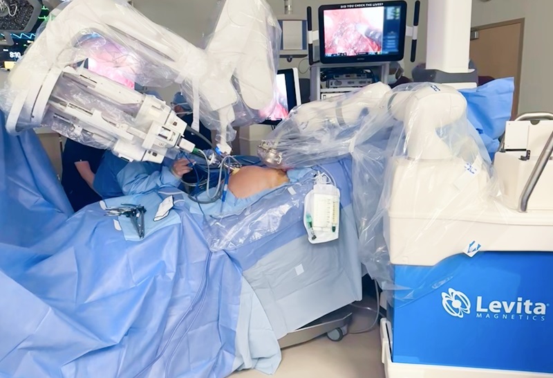 Image: The first-ever surgery performed utilizing the MARS platform and Intuitive Da Vinci SP single-port robot (Photo courtesy of Levita Magnetics)