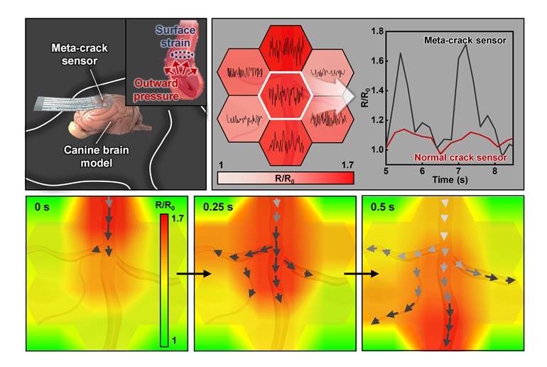 Image: Schematic illustration of biomechanical signal monitoring on the vascular surface of a canine brain model (Photo courtesy of Science Advances, doi/10.1126/sciadv.ads9258)