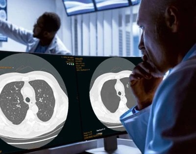 Image: The new technology adds coronary artery calcification scoring to ungated chest CT scans (Photo courtesy of Riverain Technologies) Image: The new technology adds coronary artery calcification scoring to ungated chest CT scans (Photo courtesy of Riverain Technologies)