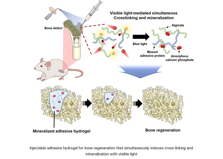 Image: The injectable adhesive hydrogel for bone regeneration simultaneously induces cross-linking and mineralization with visible light (Photo courtesy of POSTECH)