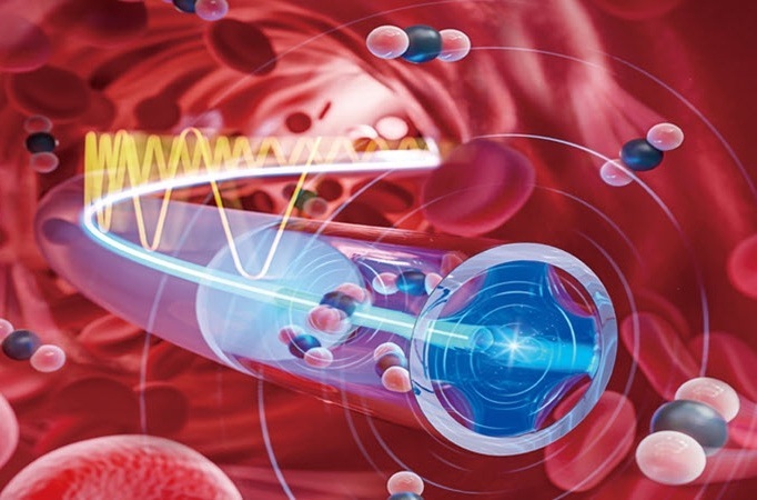 Image: The fiber photoacoustic spectrometer enables continuous intravascular gas monitoring (Photo courtesy of Jun Ma/Jinan University)