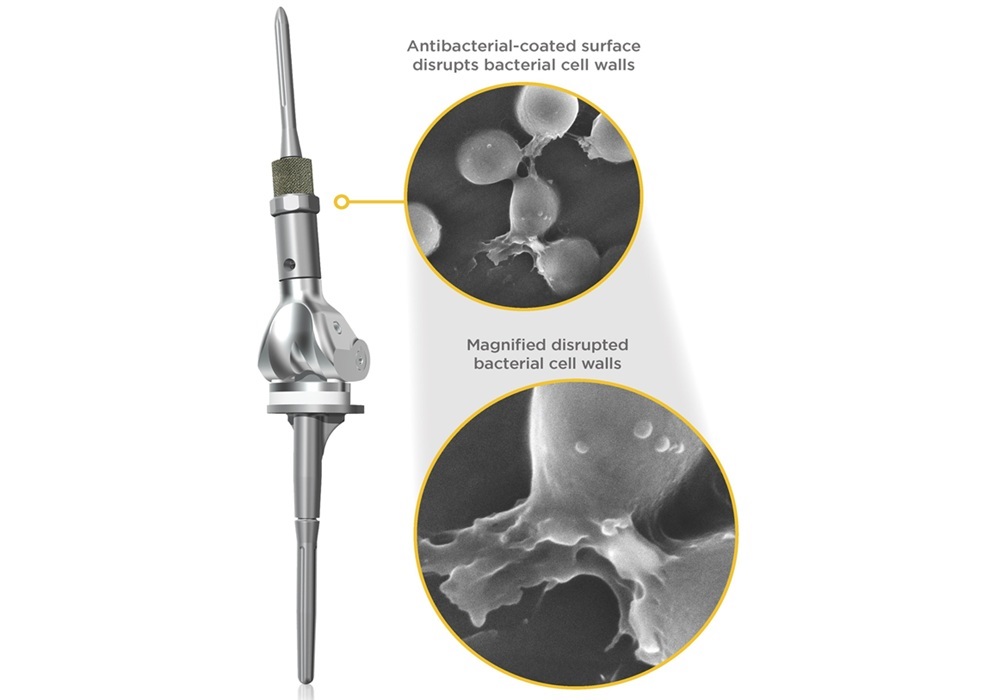 Image: The NanoCept Antibacterial Technology (Photo courtesy of Onkos Surgical)