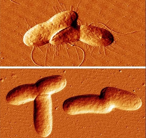 Image: Microscopy images of bacteria strains show one (top) producing fimbriae as normal and one with high level of MEcPP unable to produce the fimbriae (Photo courtesy of Jingzhe Guo/UCR)