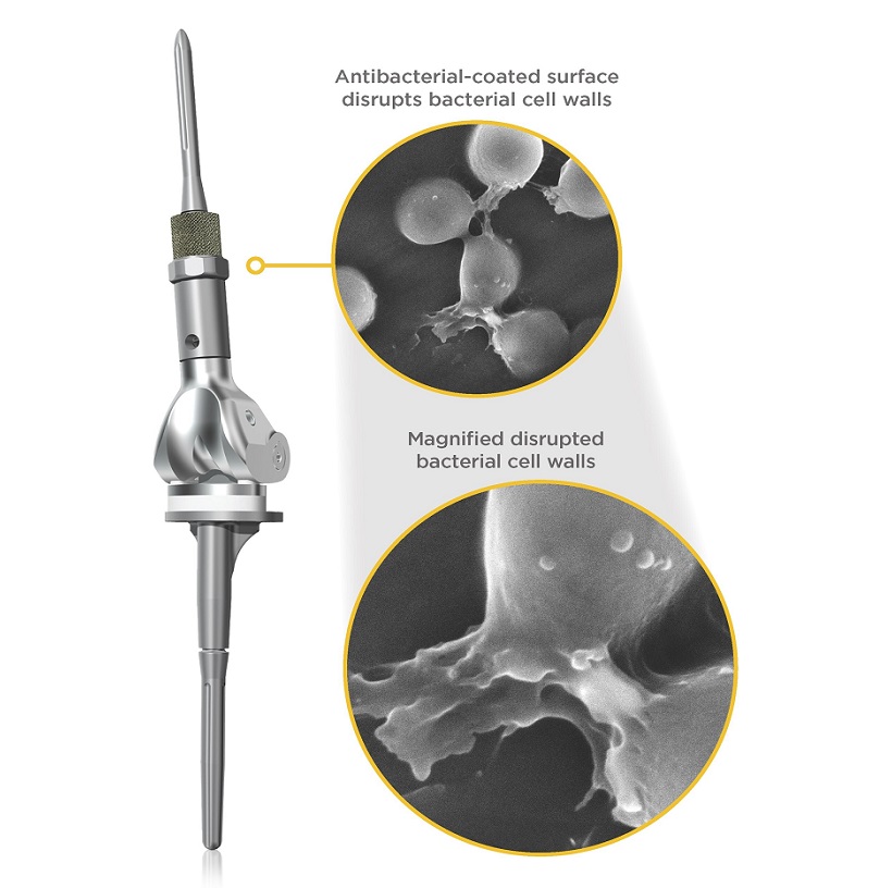 Image: The NanoCept Antibacterial Technology (Photo courtesy of Onkos Surgical)