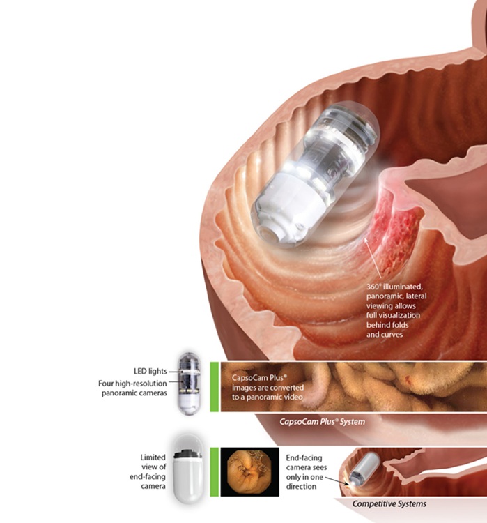 Image: The only capsule endoscopy system with 360° imaging and no wearable equipment is now available for pediatric patients (Photo courtesy of CapsoVision)