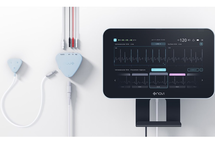 Image: The Neonav ECG Tip Location System (Photo courtesy of Navi Medical Technologies)