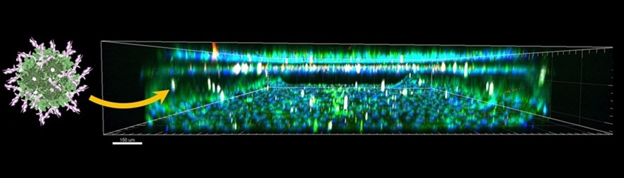 Image: The researchers created the particle at left and tested its ability to cross the blood-brain barrier via the chip at right (Photo courtesy of Medina-Kauwe Lab)