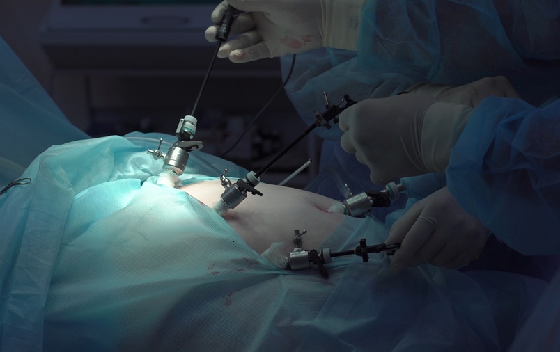 Image: Laparoscopic abdominal surgery can result in adhesions for which there is currently no treatment (Photo courtesy of 123RF)