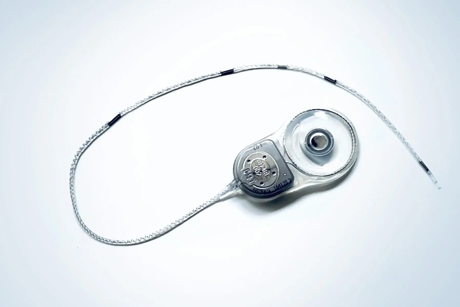 Image: The Minder Implant can record brain activity continuously for very long periods (Photo courtesy of Epiminder)