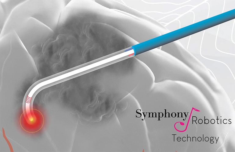 Image: The engine-free, nonlinear, flexible, micro-robotic platform leverages AI to optimize GBM treatment (Photo courtesy of Symphony Robotics)