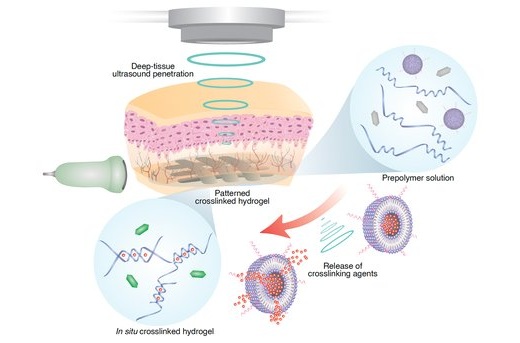 Image: the deep tissue in vivo sound printing (DISP) platform, which combines ultrasound with low-temperature–sensitive liposomes loaded with crosslinking agents (Photo courtesy of Elham Davoodi and Wei Gao/Caltech)