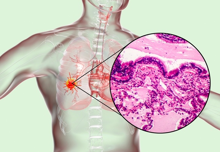 Image: The new AI-based method can predict treatment outcomes from health record data (Photo courtesy of 123RF)
