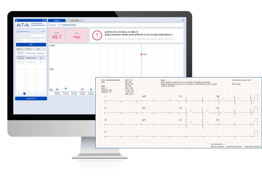 Image: The AiTiALVSD AI-ECG algorithm performed well in the early detection of heart failure in Kenya (Photo courtesy of Medical AI Co)