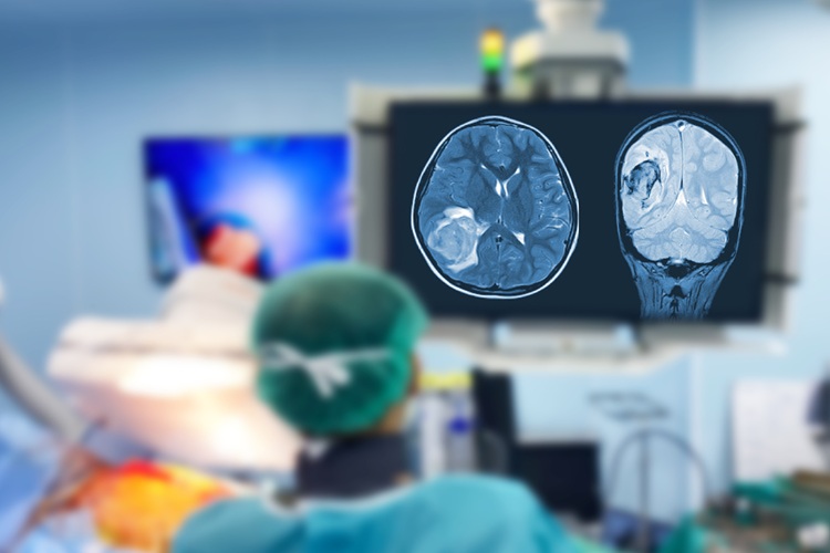 Image: Thermal imaging technology offers a breakthrough in brain surgery monitoring (Photo courtesy of 123RF)