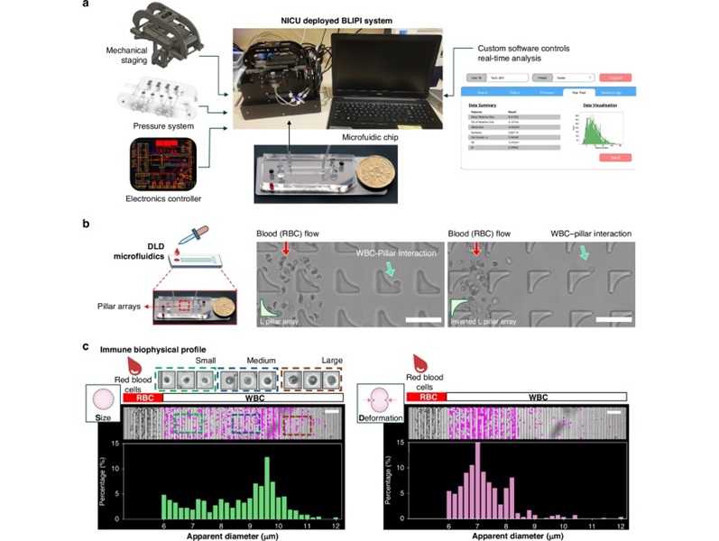Image: Custom hardware and software for the real-time detection of immune cell biophysical signatures in NICU (Photo courtesy of Pediatric Research, DOI:10.1038/s41390-025-03952-y)