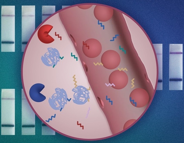 Image: The new diagnostic based on analysis of urine samples could also be designed to reveal whether a tumor has metastasized (Photo courtesy of MIT)
