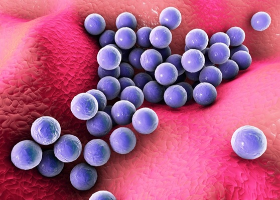 Image: Cutting-edge hospital genomics initiative takes on dangerous superbug (Photo courtesy of 123RF)