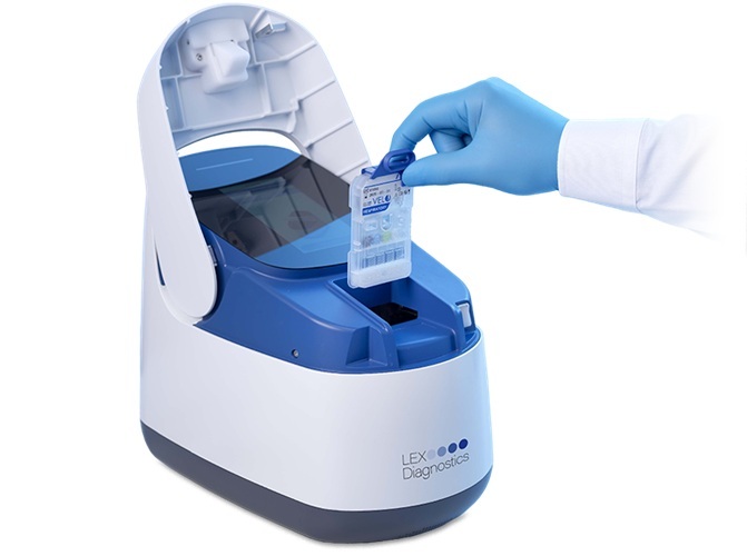 Image: The LEX VELO system aims to redefine point-of-care testing (Photo courtesy of LEX Diagnostics) Image: The LEX VELO system aims to redefine point-of-care testing (Photo courtesy of LEX Diagnostics)