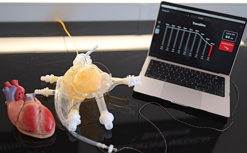 Image: The device consists of a probe and a balloon, which is placed in the sac around the heart during surgery (Photo courtesy of Fallouh Healthcare)
