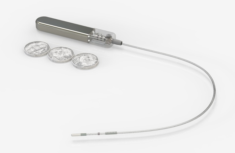 Image: The fully implantable CBGM system can make glucose monitoring less burdensome (Photo courtesy of Glucotrack)