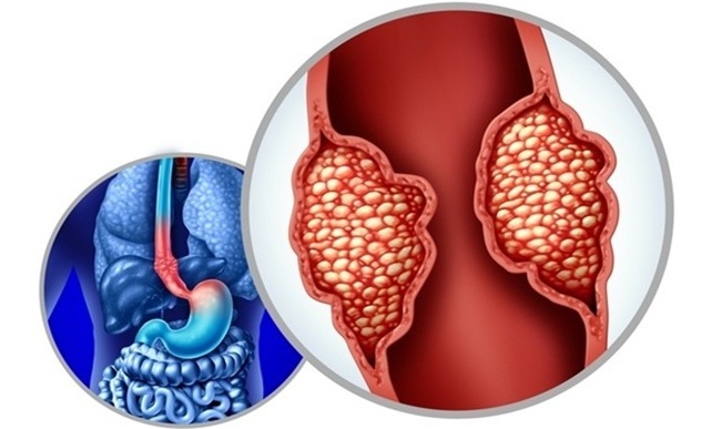 Image: New findings reveal how shifts in gene expression compromise esophageal identity, setting the stage for cancer development (photo courtesy of Shutterstock)