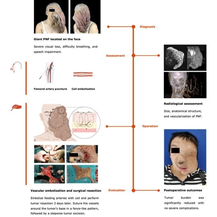 Image: Workflow of the entire process before, during, and after surgery (Photo courtesy of Zhichao Wang, et al)