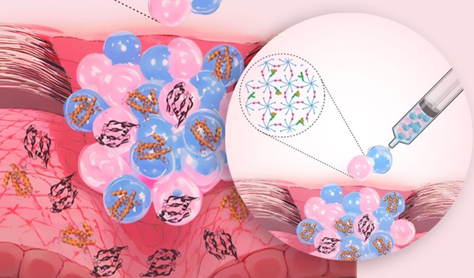 The intelligent wound dressing consists of a granular hydrogel (Photo courtesy of Apoorv Singh/ETH Zurich)