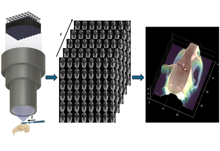 Image: FiLM-Scope simultaneously captures 48 multiperspective images of a surgical scene. Using a custom reconstruction algorithm, these images can be converted into a dense 3D model (Image courtesy of Clare B. Cook/Duke University)