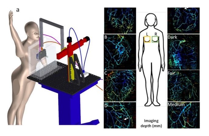 Image: The automated breast scan takes less than a minute and produces AI-powered, clear 3D images (Photo courtesy of University at Buffalo) Image: The automated breast scan takes less than a minute and produces AI-powered, clear 3D images (Photo courtesy of University at Buffalo)