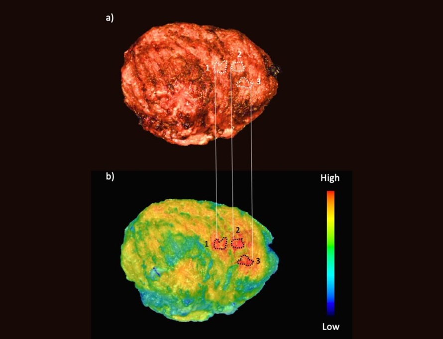 Image: For the first time, a fluorescent-guided nerve imaging agent has shown promise for use in humans (Photo courtesy of VUMC)